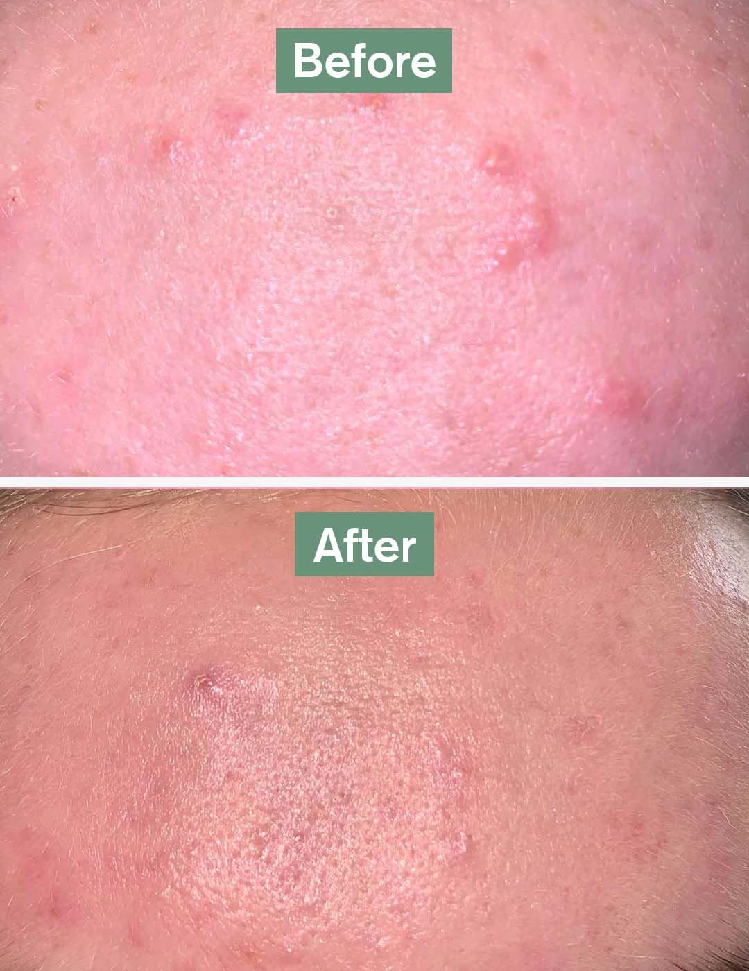 Dr. Vegan Skin Saviour - 60 Capsules