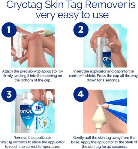Cryotag Skin Tag Remover - Fast Effective Safe - Up to 12 Treatments