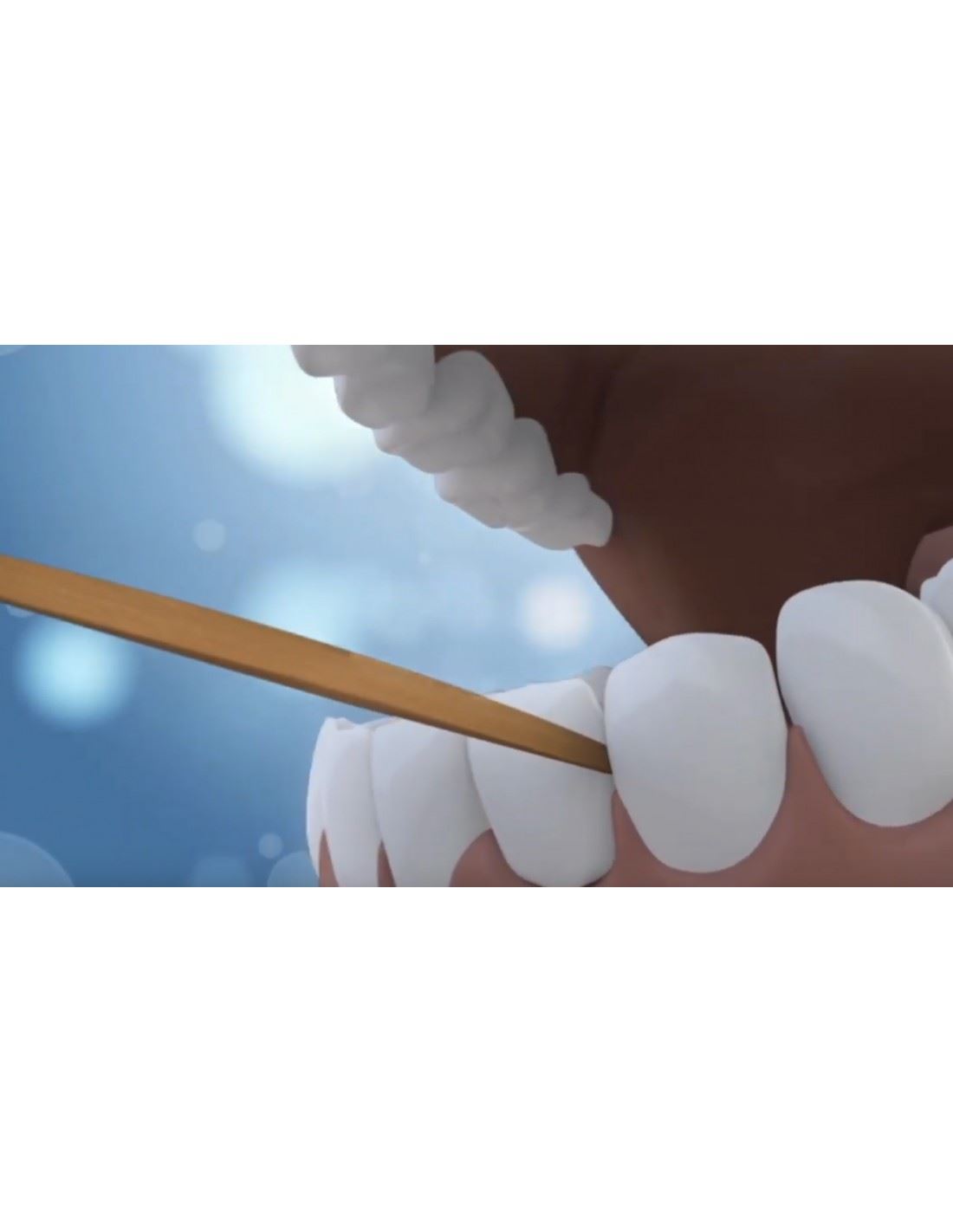 Dr Tung's Perio Sticks X-Thin