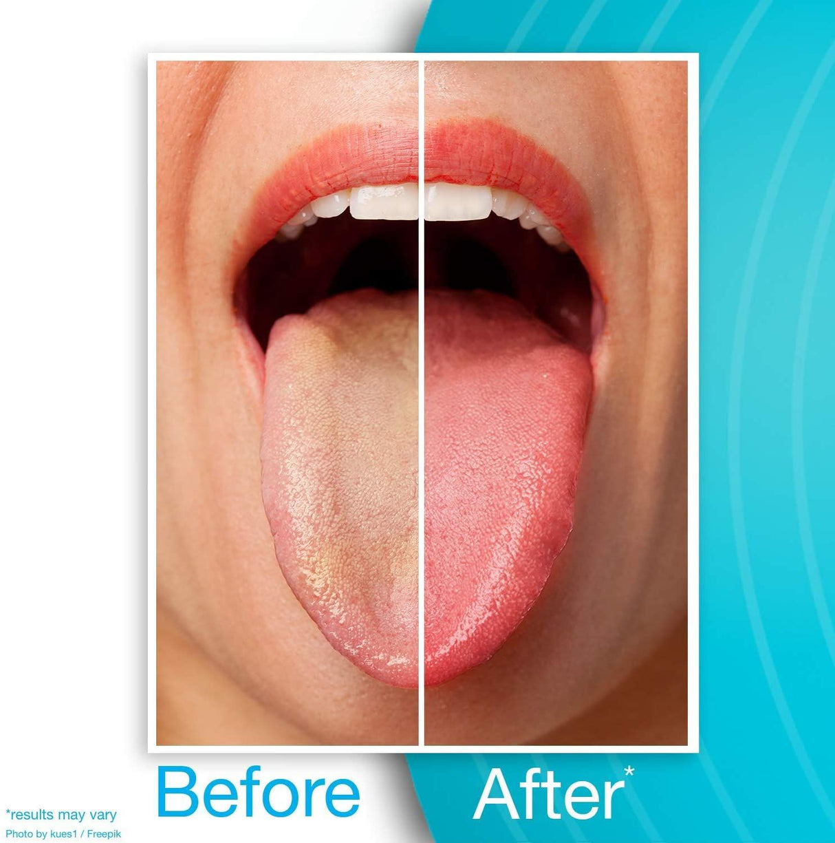 Dr Tung's Stainless Steel Tongue Cleaner